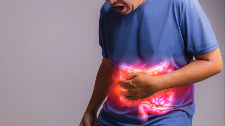 Appendicitis
